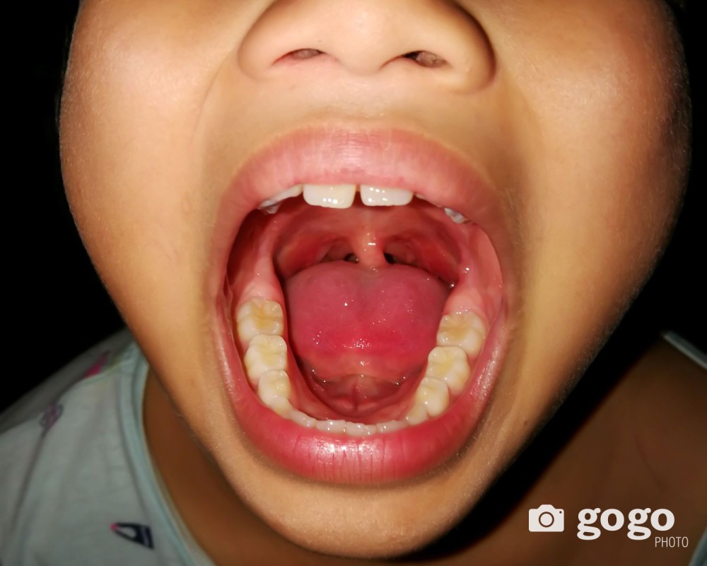 14-18 насны 3000 сурагчид чих, хамар хоолойн эрүүл мэндийн суурь мэдлэг олгоно