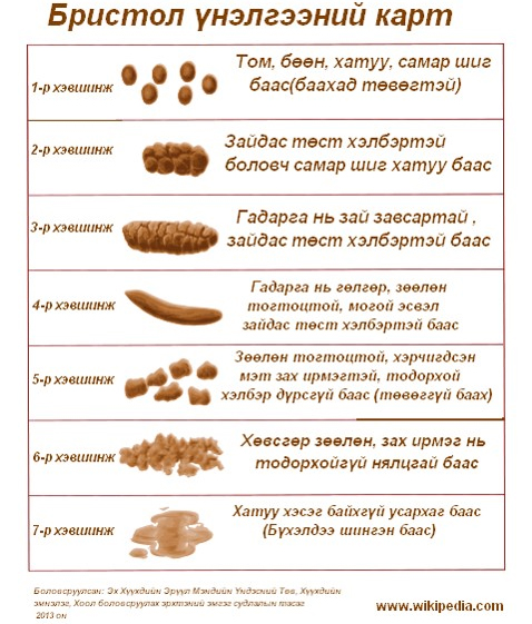 Зураг дээрх 1-3 дугаар хэв шинж нь өтгөн хатсаныг, 4-5 хэв шинж нь хэвийн байдлыг, 6-7 нь шингэн алдалттай байгааг илтгэнэ.