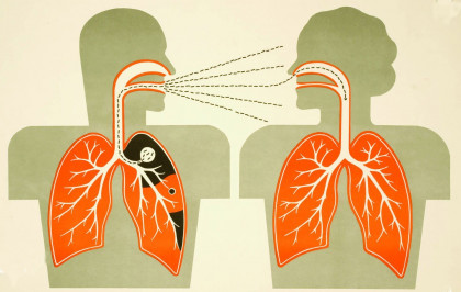 Сүрьеэ өвчнөөс хэрхэн сэргийлэх вэ?